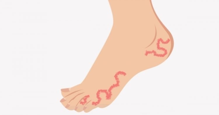 Bicho geográfico na praia