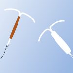 O que é o contraceptivo DIU