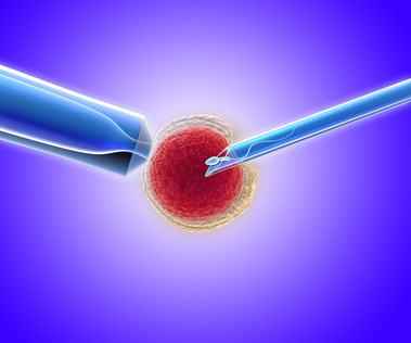 o que é a fertilização in vitro