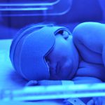 Bebé com icterícia