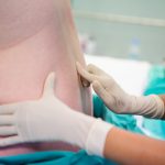 Efeitos secundários epidural