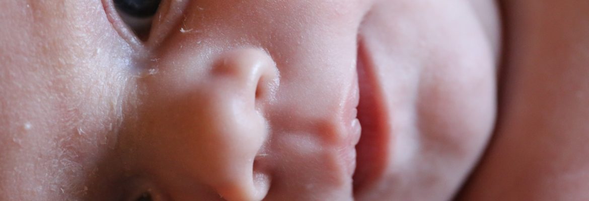 Borbulhas na cara do bebé recém-nascido