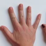 Unhas fracas depois da gravidez