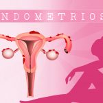 Endometriose e gravidez