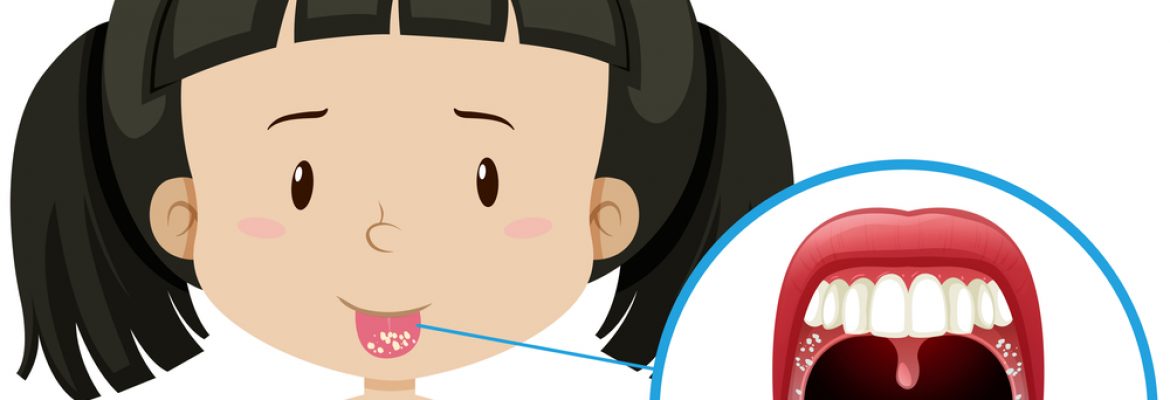 Sapinho na boca do bebé