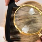 seu filho pode ter piolhos