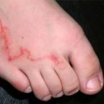 Bicho geográfico na praia