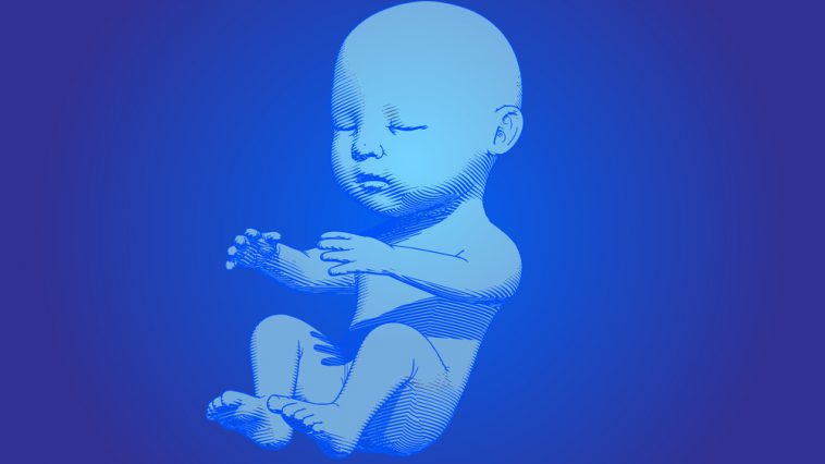 perder líquido amniótico